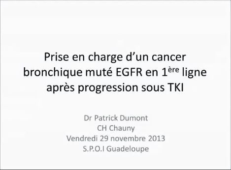Prise en charge d'un cancer bronchique muté EGFR en 1ère ligne après progression sour TKI - Dr Patrick Dumont