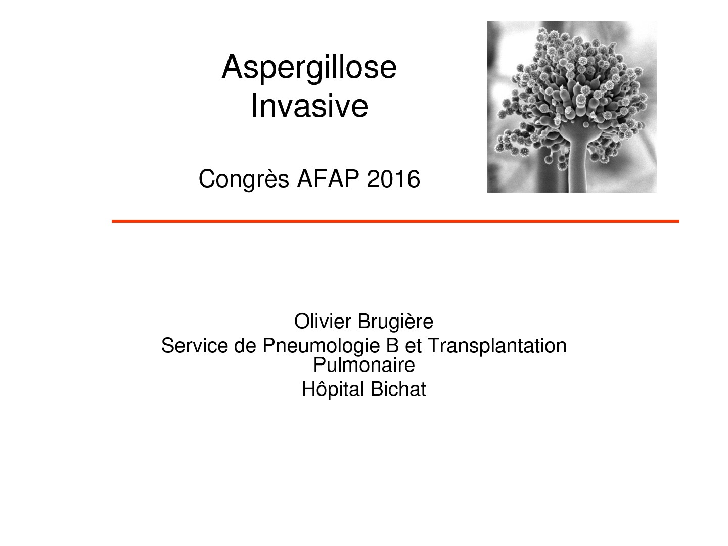 Aspergillose invasive. Olivier Brugière