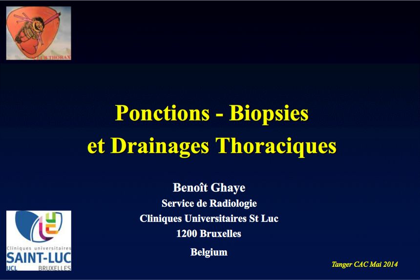 Ponction - Biopsie et Drainage Thoraciques. Benoit Ghaye