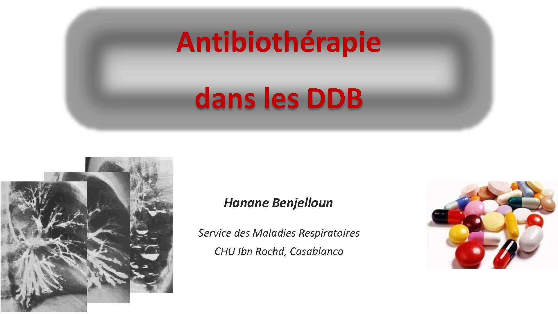 Antibiothérapie dans les DDB. N. YASSINE (Casablanca)