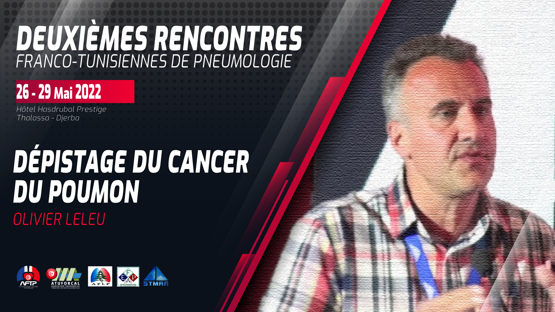 Dépistage du cancer du poumon. Olivier Leleu