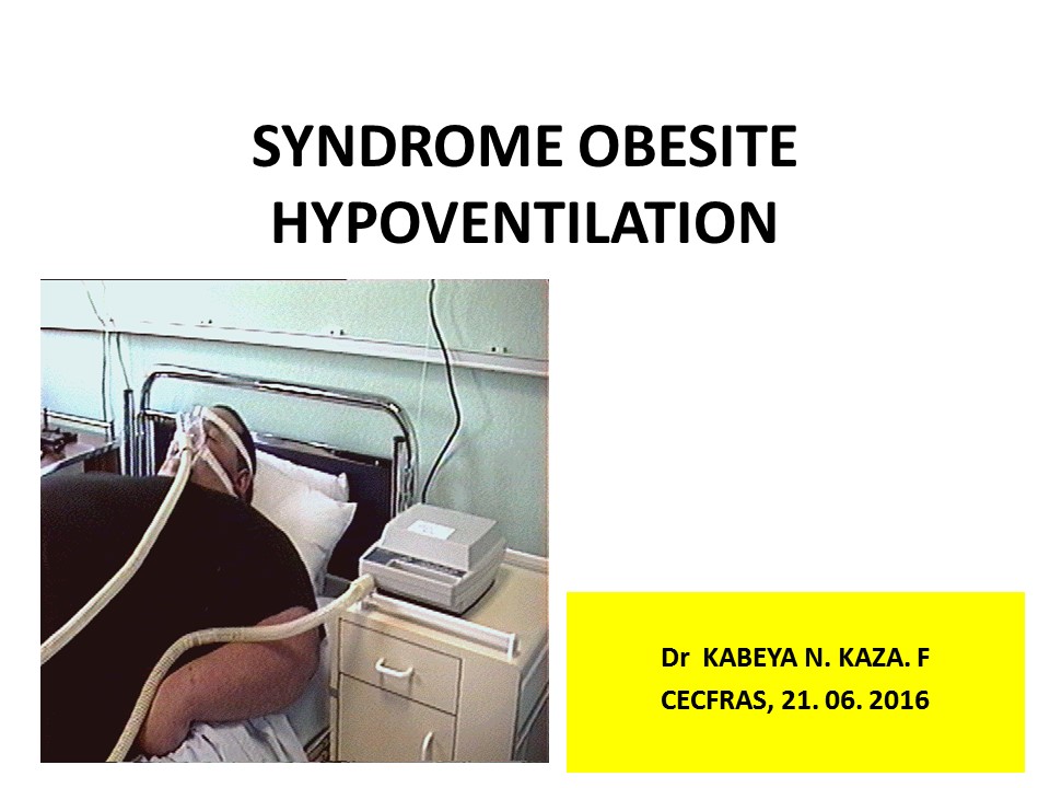 Syndrome Obésité Hypoventilation. Franck Kabeya