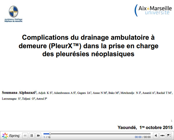 Complications du drainage ambulatoire à demeure PleurX dans la prise en charge des pleurésies néoplasiques. S. Alphazazi
