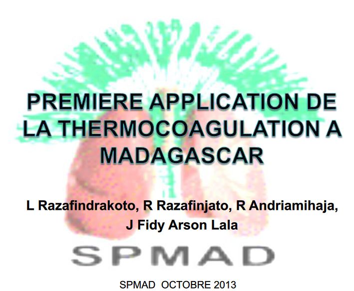 Première application de la thermo coagulation bronchique à Madagascar. Dr ANDRIAMIHAJA