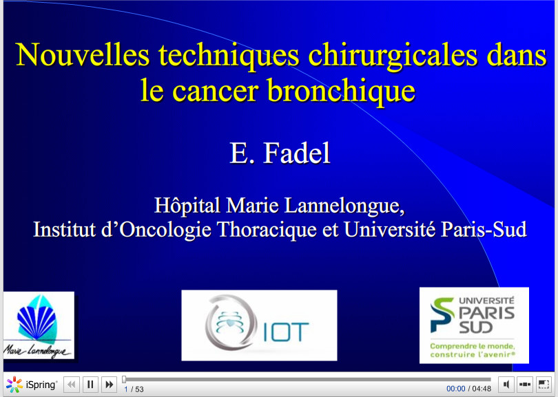 Nouvelles techniques chirurgicales dans le cancer bronchique . E. Fadel