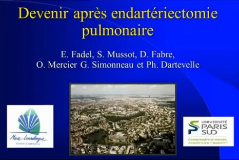 Devenir après Thromboendartériectomie - Pr Elie Fadel, Paris