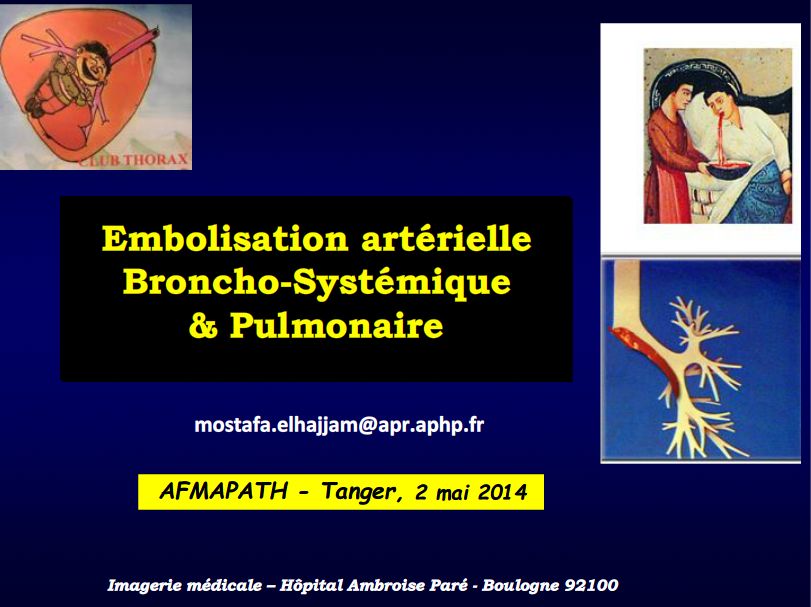 Embolisations artérielles broncho-systémiques et pulmonaires. Mustapha El Hajjam