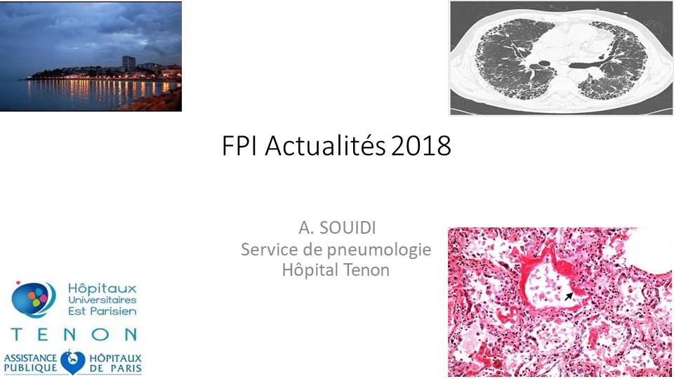 La FPI : Actualités 2018. A. Souidi