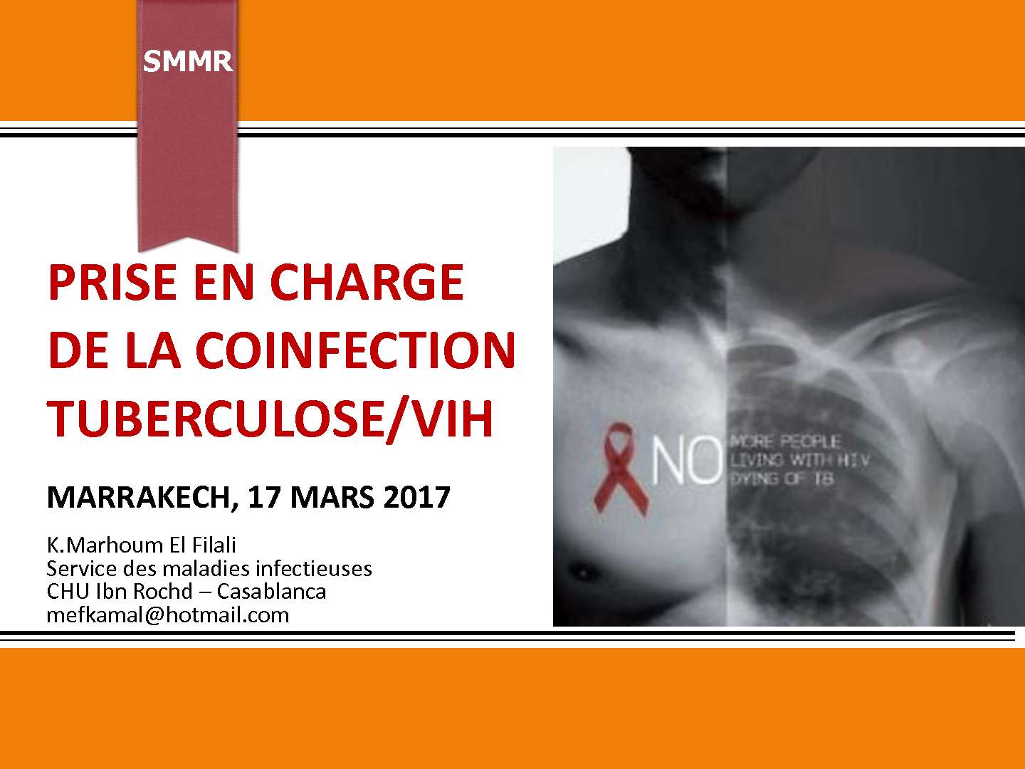 Prise en charge de la co-infection VIH-tuberculose. K. MARHOUM FILALI (Casablanca)