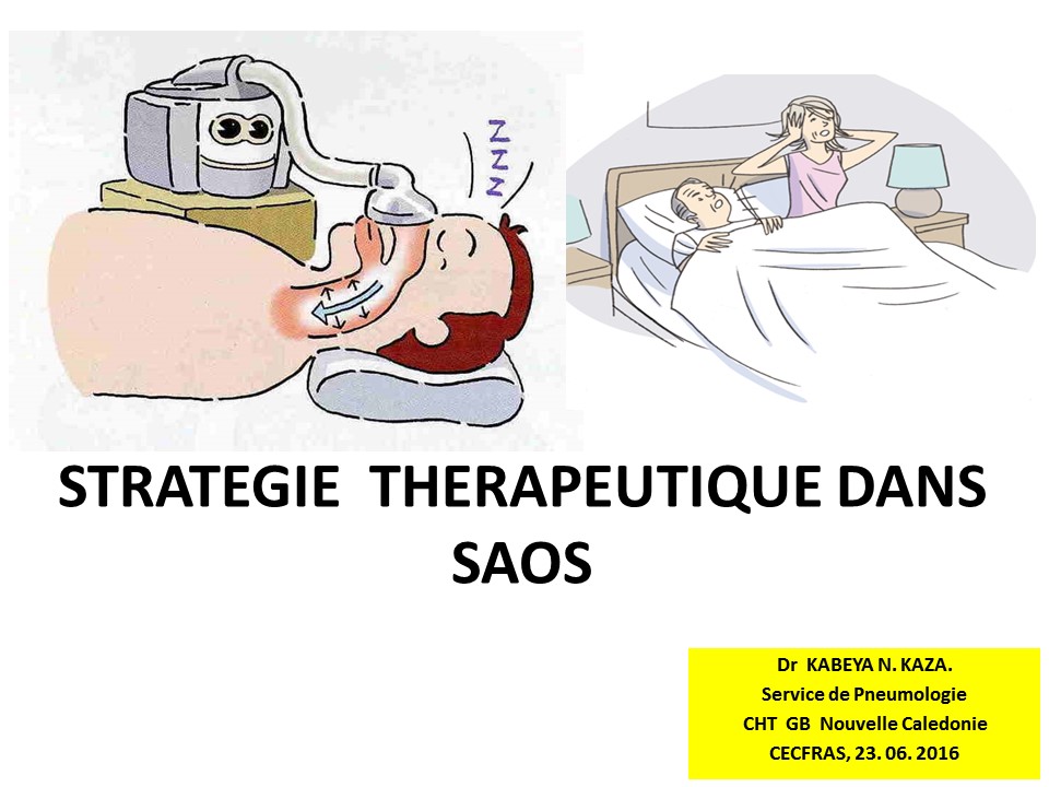 Stratégie thérapeutique du SAOS. Franck Kabeya