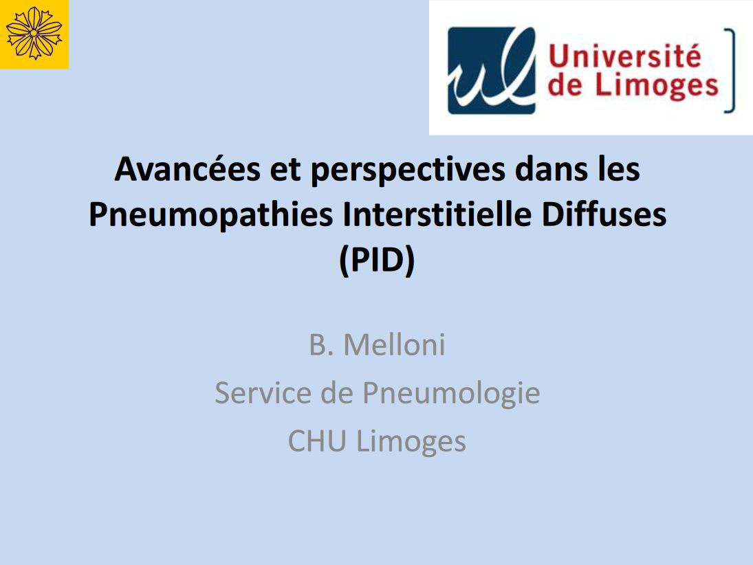 Avancées et perspectives dans les pneumopathies interstitielles diffuses PID. Boris Melloni