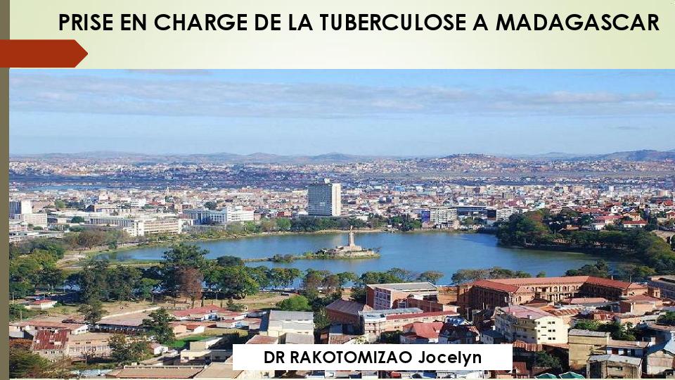 Prise en charge de la tuberculose à Madagascar. Rakotomizao Jocelyn